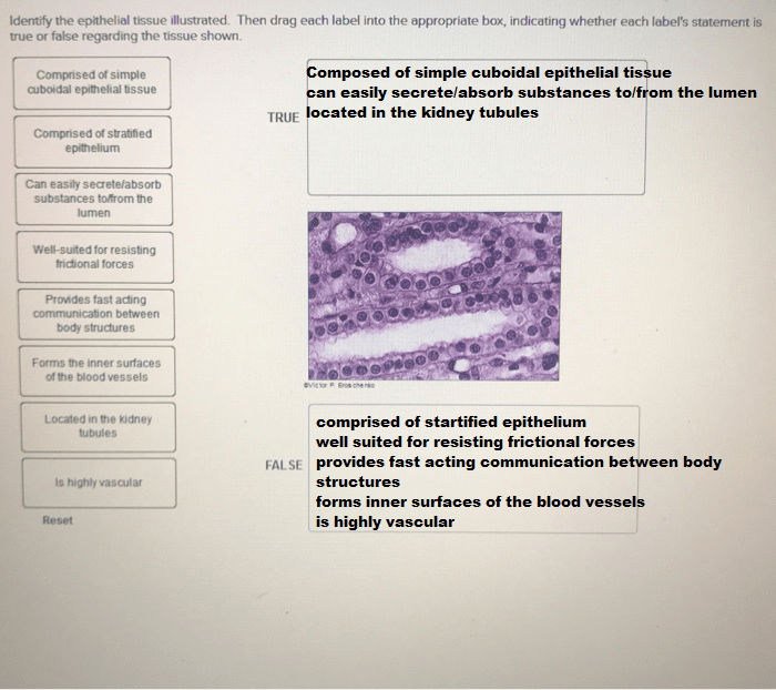 Drag each label to the appropriate bone marking.