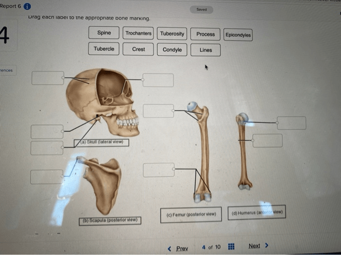 Drag each label to the appropriate bone marking.